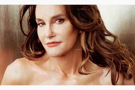 Caitlyn Jenner on the July cover of Vanity Fair underwent facial feminization surgery as part of her transition