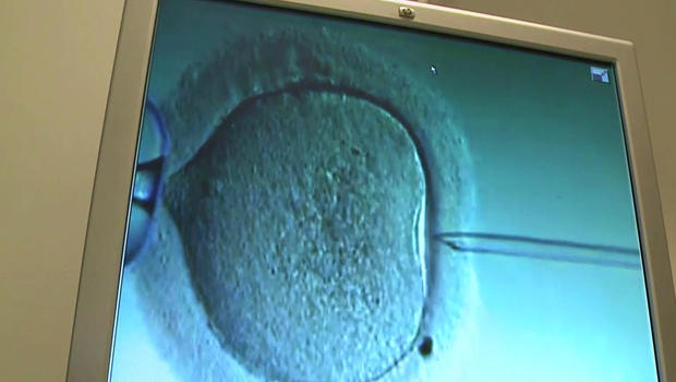 A divorced California couple is in the middle of a court battle over the rights to a frozen embryo they created.         
                                     CBS