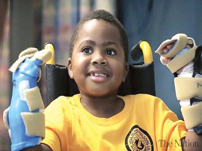 Maryland boy becomes youngest to receive double hand transplant