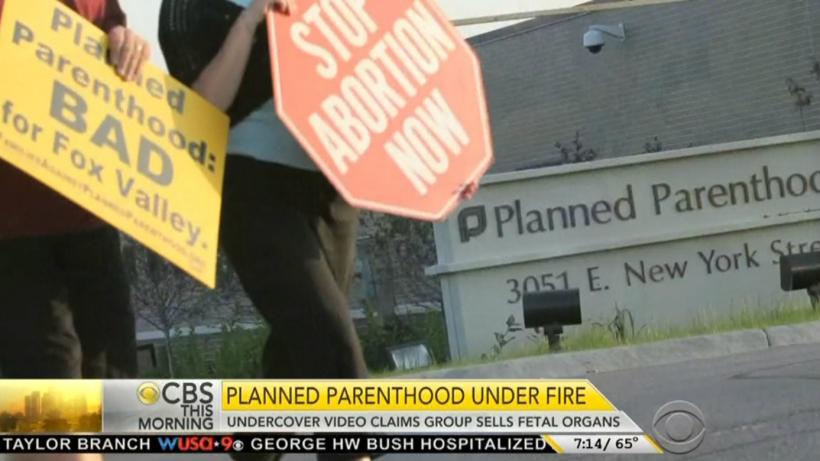 Planned Parenthood Chief Defends Controversial Fetal Tissue Donations