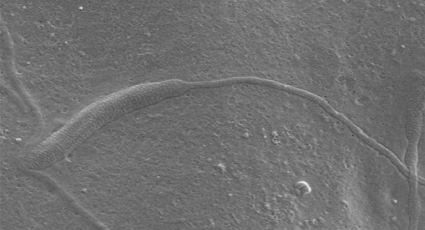 Surprise Find in Antarctica: Oldest Animal Sperm