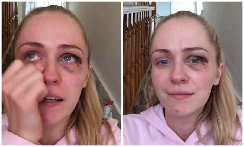 Domestic abuse victim posts video online after finally breaking up with partner