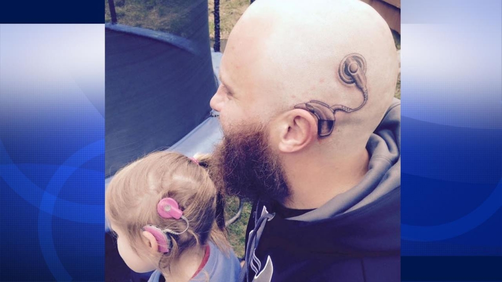 Alistair Campbell shows off the tattoo he got of a cochlear implant that matches his hearing impaired six-year-old daughters cochlear implant