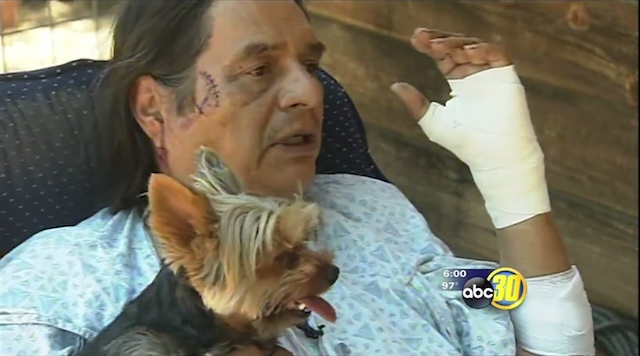 Larry Yepez showing off his battle scars says his Yorkie Benji helped save his life