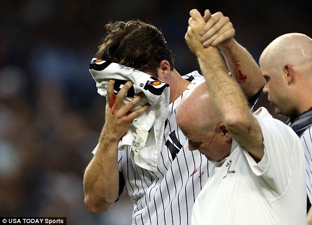 Pitcher Bryan Mitchell's head was hit by a line drive sending him off the field with a towel over his bloody face