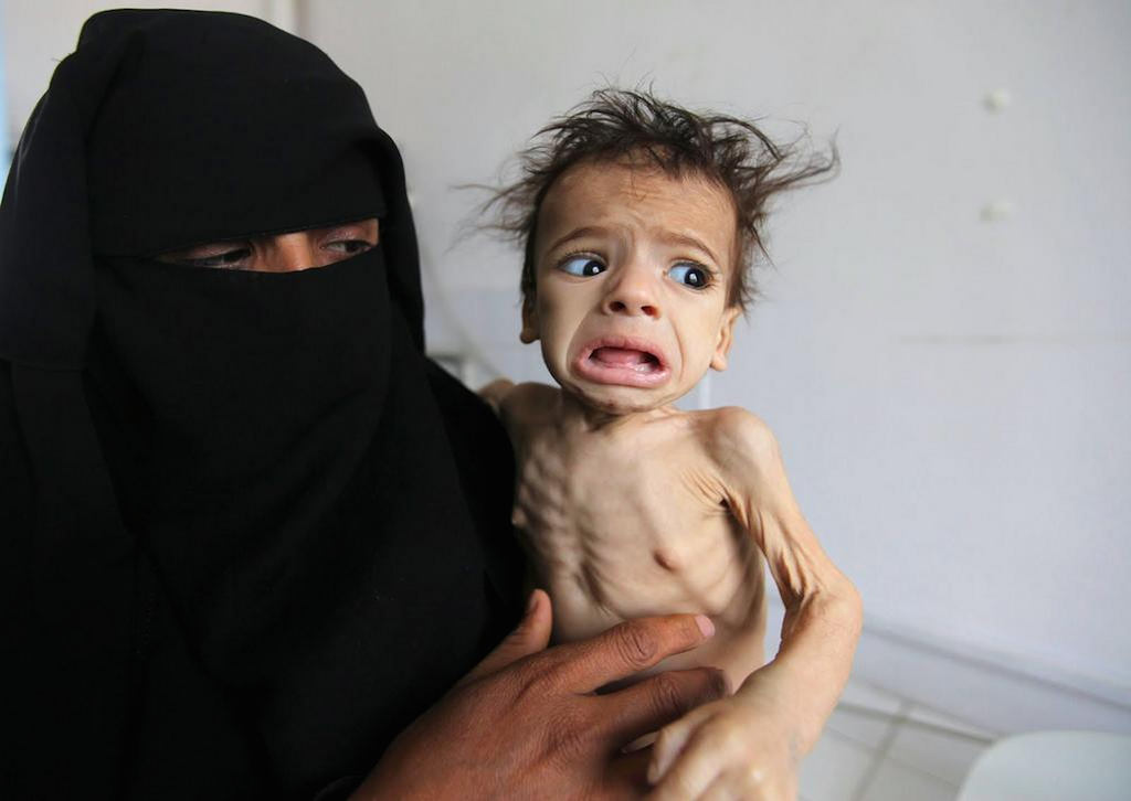 Yemen Famine