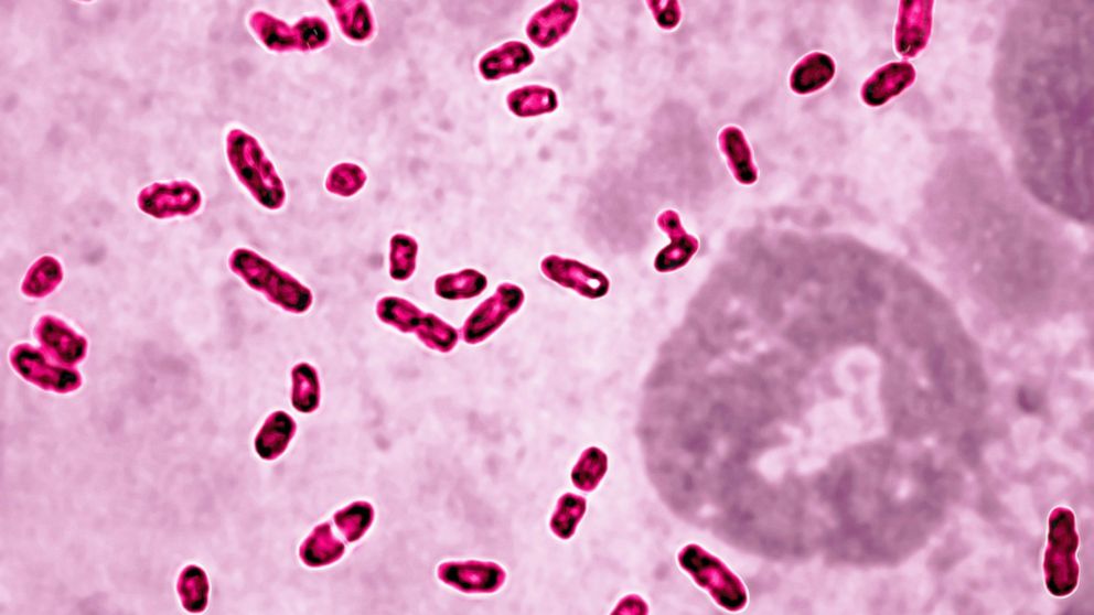 Yersinia Pestis