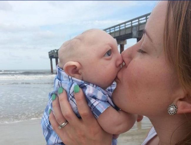 Jaxon Strong: Baby with Microhydranencephaly is an inspiration