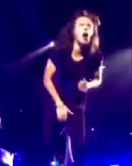 Ouch! That looks painful for poor Harry Styles