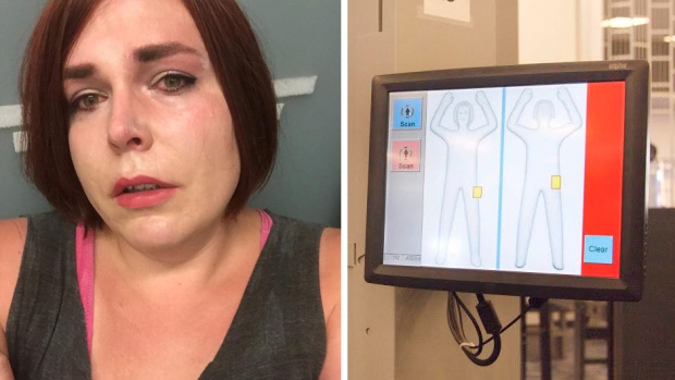 Transgender woman says TSA detained, humiliated her over body 'anomaly'