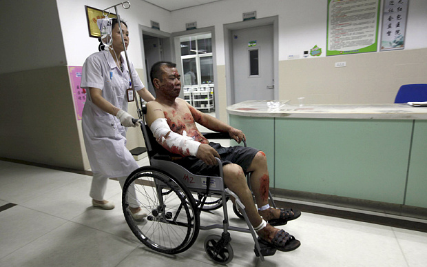 A man injured by explosions is pushed on a wheelchair at a hospital in Liucheng