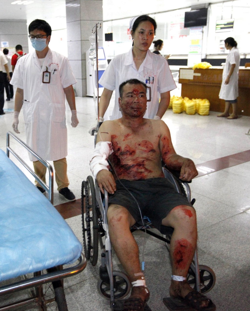 A victim being treated at a hospital in Liuzhou. Seven people were killed when 17 bombs went off in Liuzhou on Wednesday