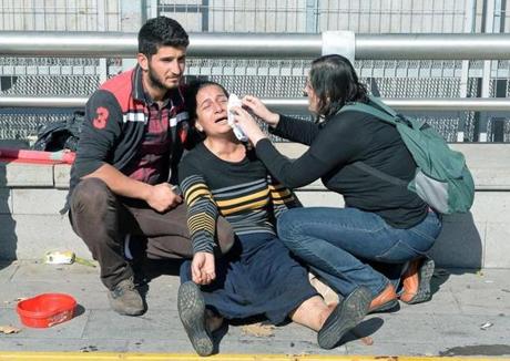 A woman was helped following an explosion at the main train station in Turkey’s capital Ankara