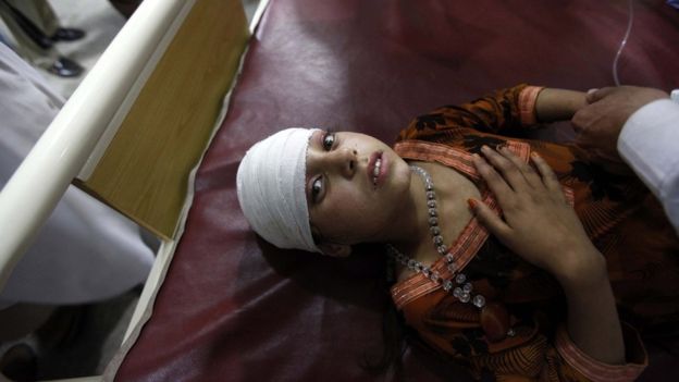 This girl was among those being treated at a hospital in Peshawar in Pakistan