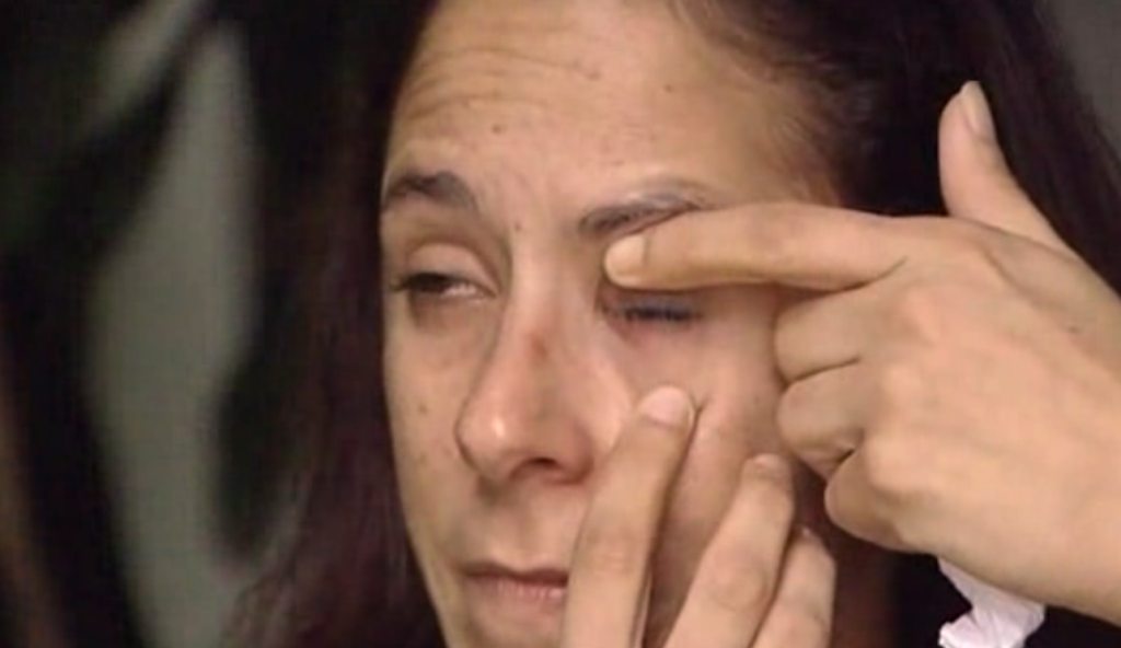 Woman mistakes glue for eye drops, glues eye shut