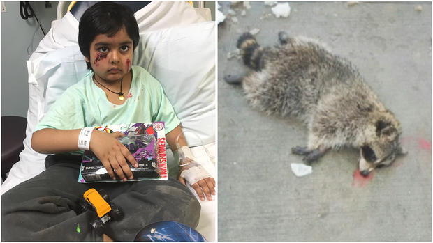 Neighbor Rescues Boy 6 from Mauling Raccoon in NJ