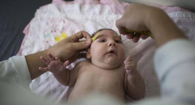 Zika Virus outbreak Don’t get pregnant for at least 2 years warn Health officials across globe