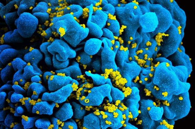 Artificial receptors kill cells infected with the virus that causes AIDS study finds