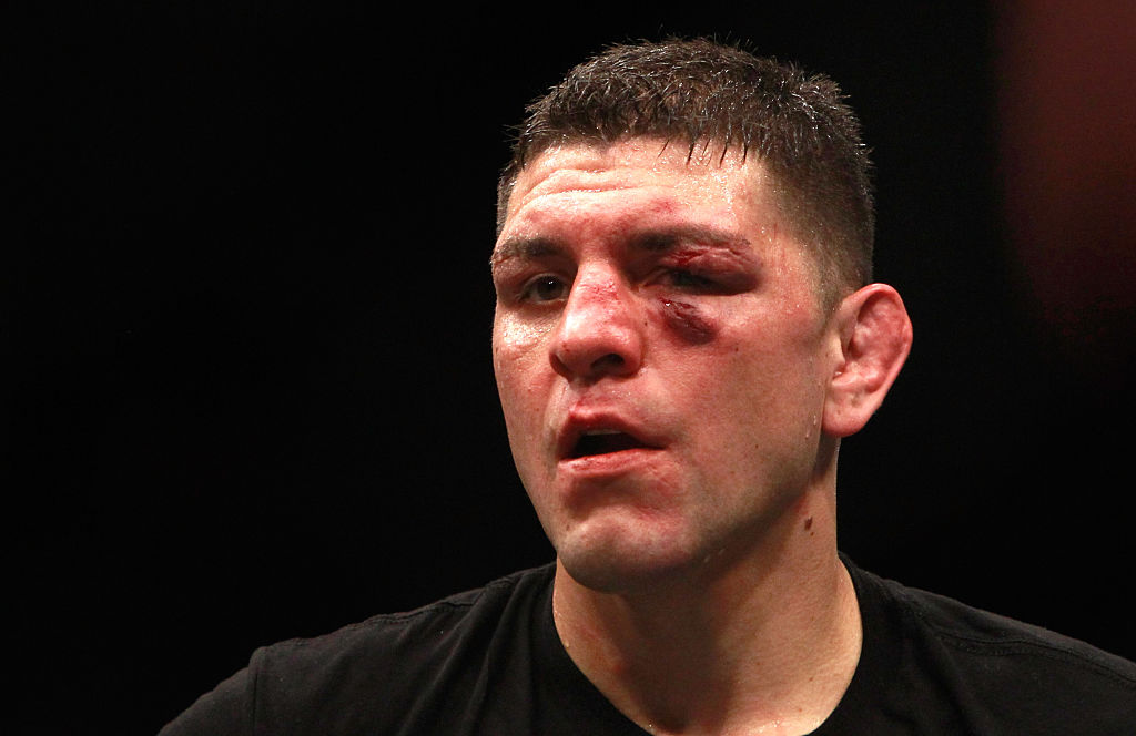 LAS VEGAS NV- JANUARY 31 Nick Diaz stands in the Octagon after five rounds against Anderson Silva in a middleweight bout during UFC 183 at the MGM Grand Garden Arena