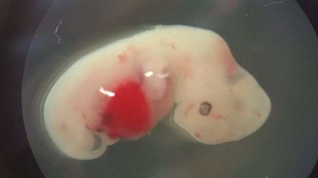 A four-week-old human-pig embryo