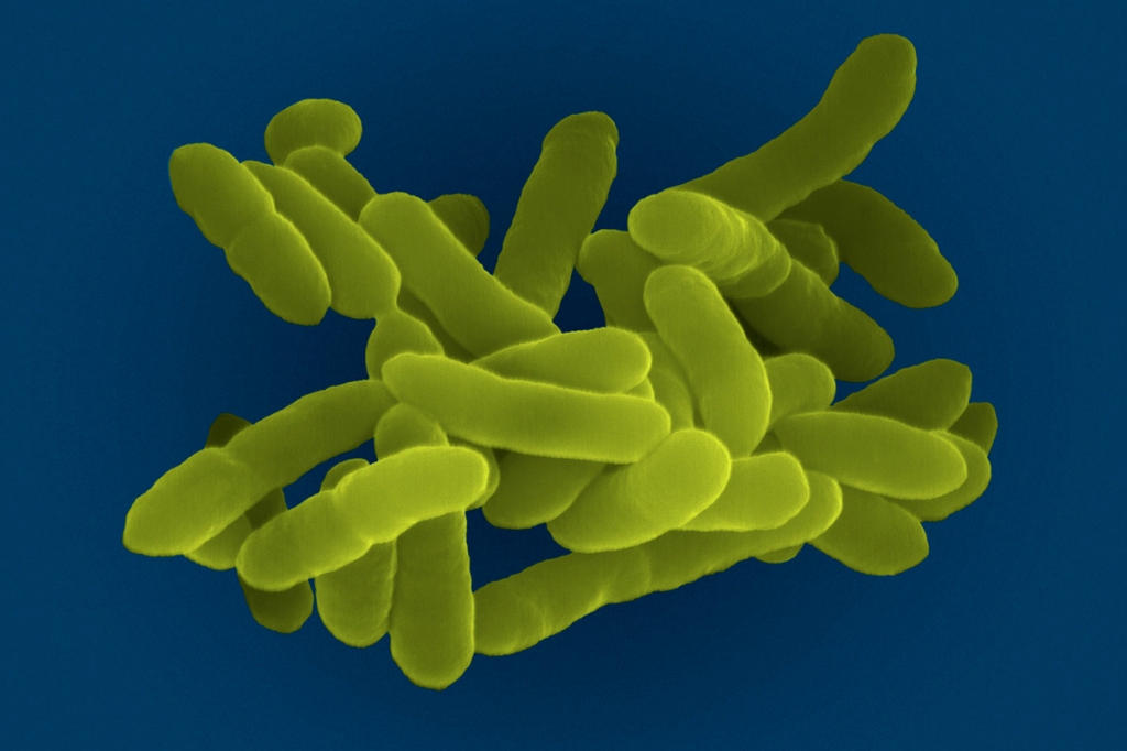 Klebsiella bacteria