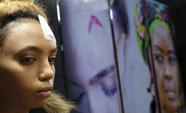 South African model Gabriella Engels allegedly assaulted by Zimbabwe First Lady Grace Mugabe looks on during a press conference at the civil rights organization Afri Forum on Thursday