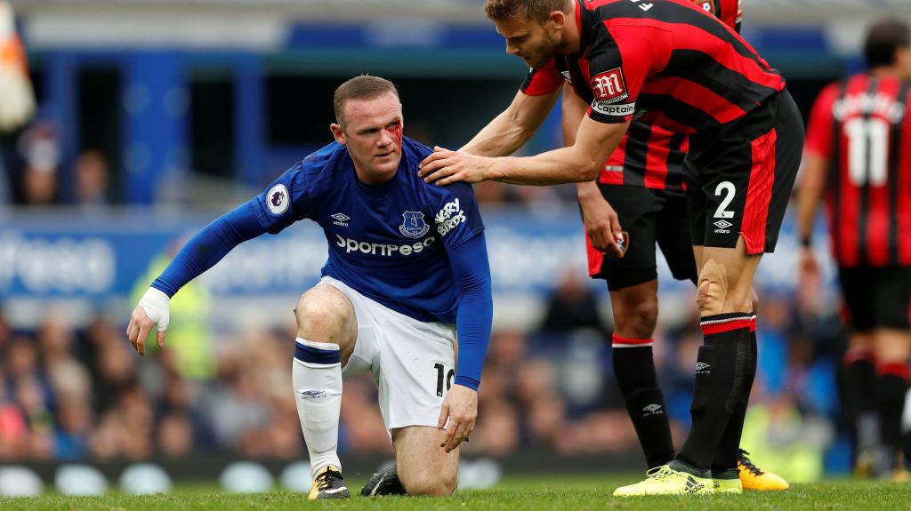 Wayne Rooney bleeds the face from sustaining an injury after Bournemouth's Simon Francis made contact with his elbow