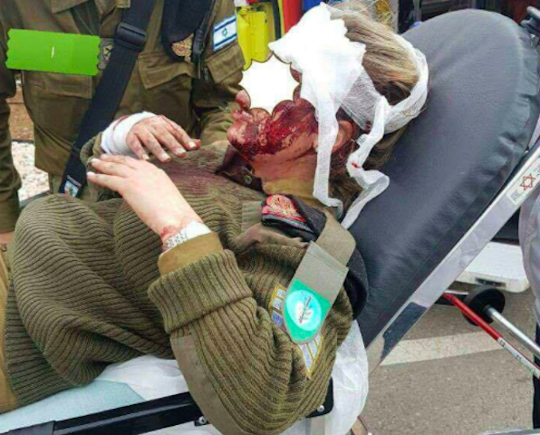 Wounded solider after being attacked by mob in Jenin