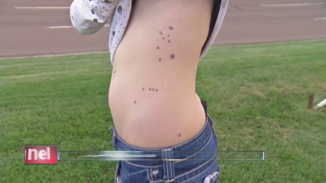 Aurora theater shooting survivors show 7NEWS the tattoos they now have to permanently mark the physical and mental scars they endured.                      KMGH