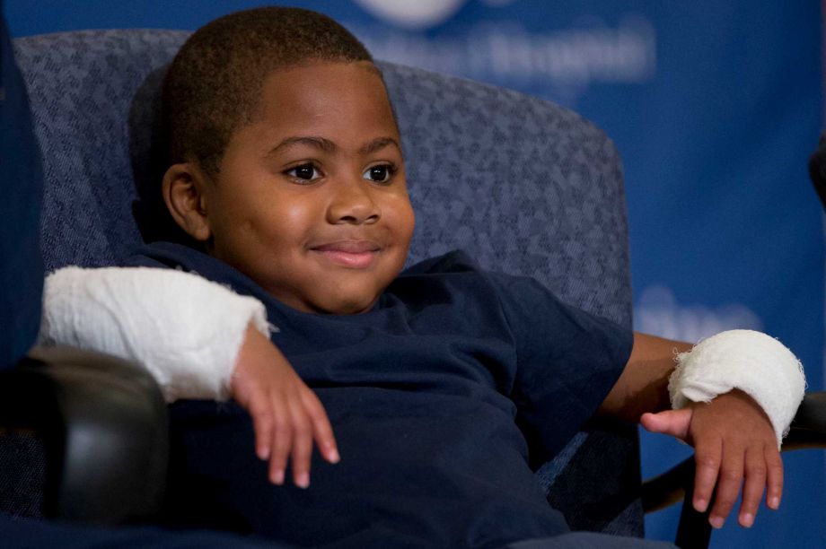 Double-hand transplant recipient Zion Harvey 8 contracted sepsis as a toddler later resulting in the forced amputation of both his hands and feet