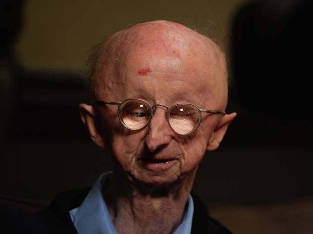 Disabled pensioner Alan Barnes moving to Shetland after mugging