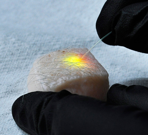 Matjaž Humar  Seok Hyun Yun	An optical fibre is shown activating tiny lasers created within pig skin cells