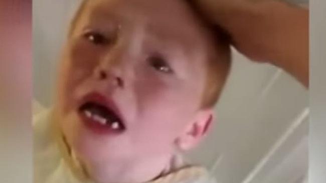 In pain... Conner Harvey seven has suffered third-degree burns after being left out