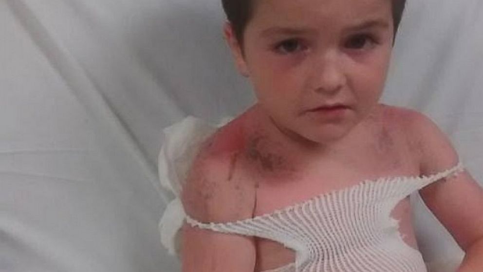 Sunburns Trigger Daycare Probe - Myhighplains.com - Powered by KAMR LOCAL 4