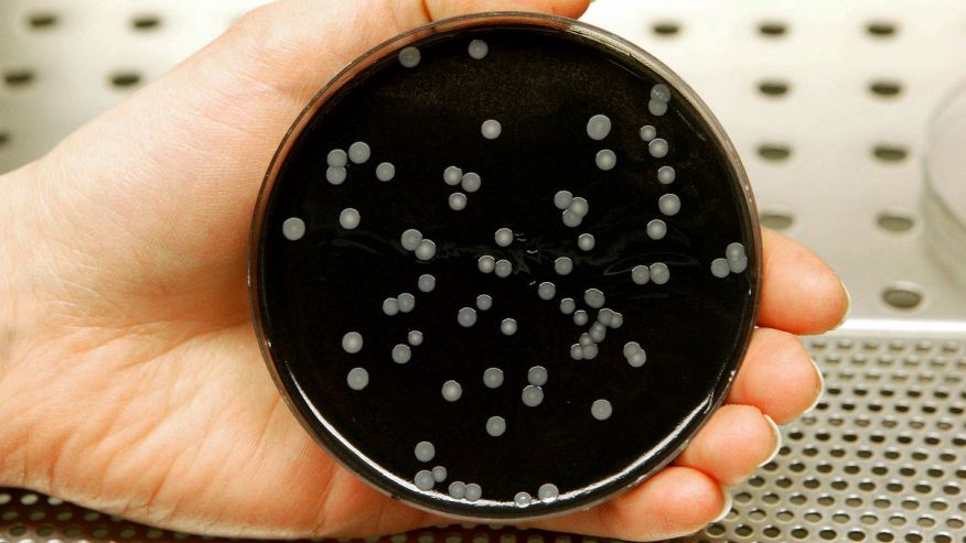 A technician holds a culture dish with colonies of legionella in a laboratory