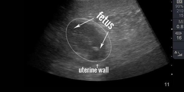 Zoo thinks panda Mei Xiang is pregnant, see her ultrasound