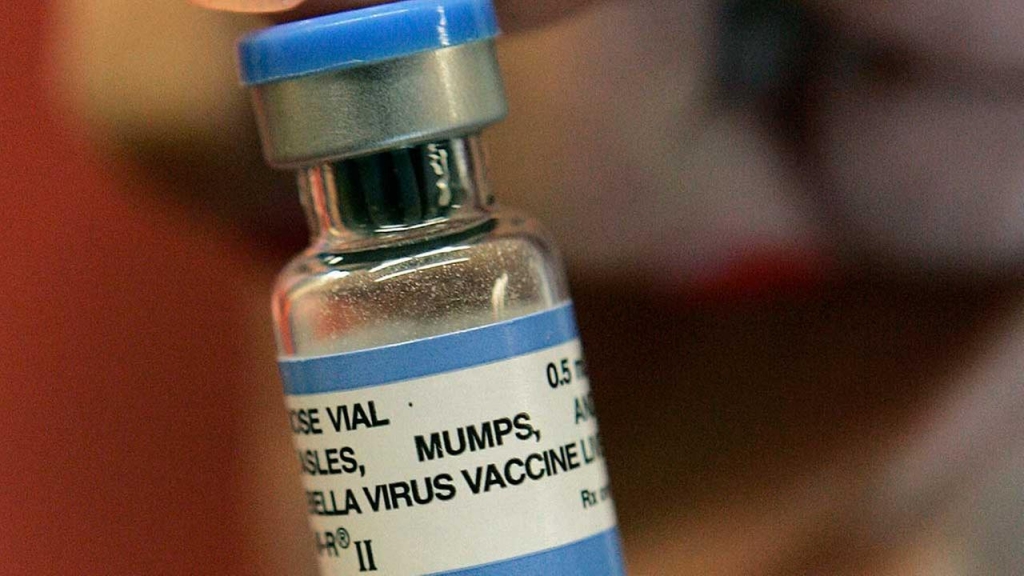 Mumps outbreak reported at U of I Champaign-Urbana