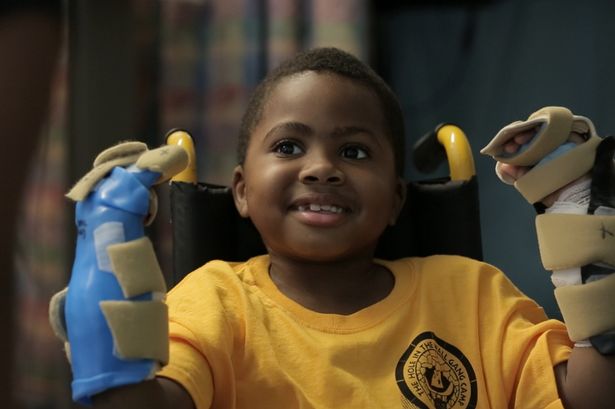 Zion Harvey- the youngest patient to receive a double-hand transplant