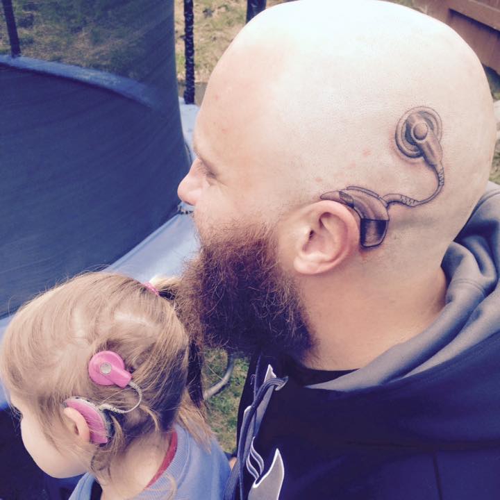 Father gets cochlear implant tattoo to match his daughter