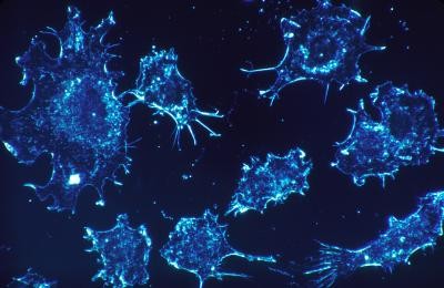 What makes cancer cells different from normal ones is that they divide at an accelerated rate