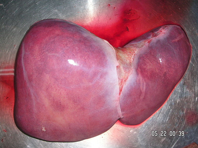 The Human Liver