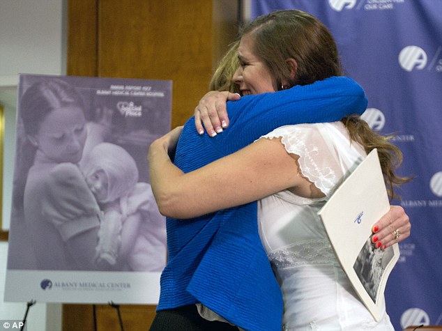 A woman who suffered severe burns as a baby has been reunited with the nurse who cared for her almost 38 years ago thanks to a Facebook appeal