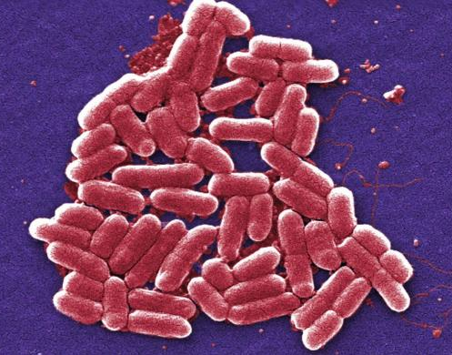 Shigella Infections is on rise in Kansas