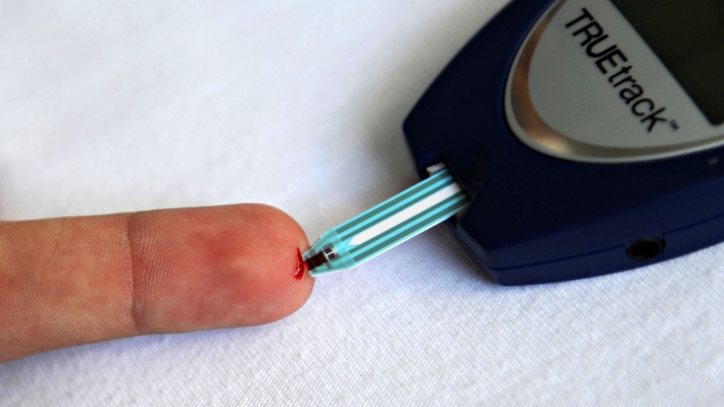 ELMER MARTINEZ  AFP  Getty Images
A patient with diabetes monitors his blood glucose with a glucometer