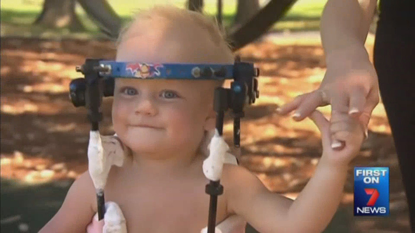 Toddler's head reattached to spine after car crash