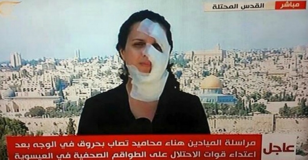 Lebanese TV reporter Hana Mahameed was shot in the face by Israeli forces while reporting live from an Arab neighborhood in Jerusalem