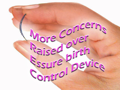 Essure manufactured by Bayer Healthcare is a permanent birth control device that blocks the fallopian tubes thus preventing pregnancy