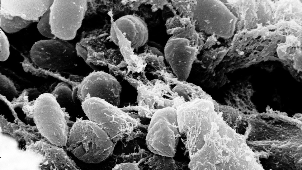 The Plague Has Been Around For a Lot Longer Than We Thought