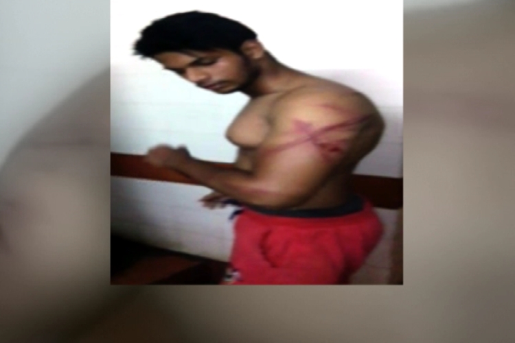 The two victims Asif Shaikh and Danish shaikh were allegedly beaten with belts and batons through the night after being picked up by cops