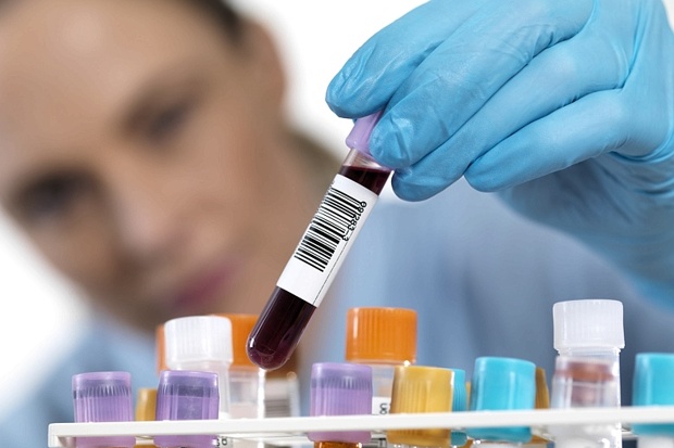 Scientist holding blood sample in a test tube rack